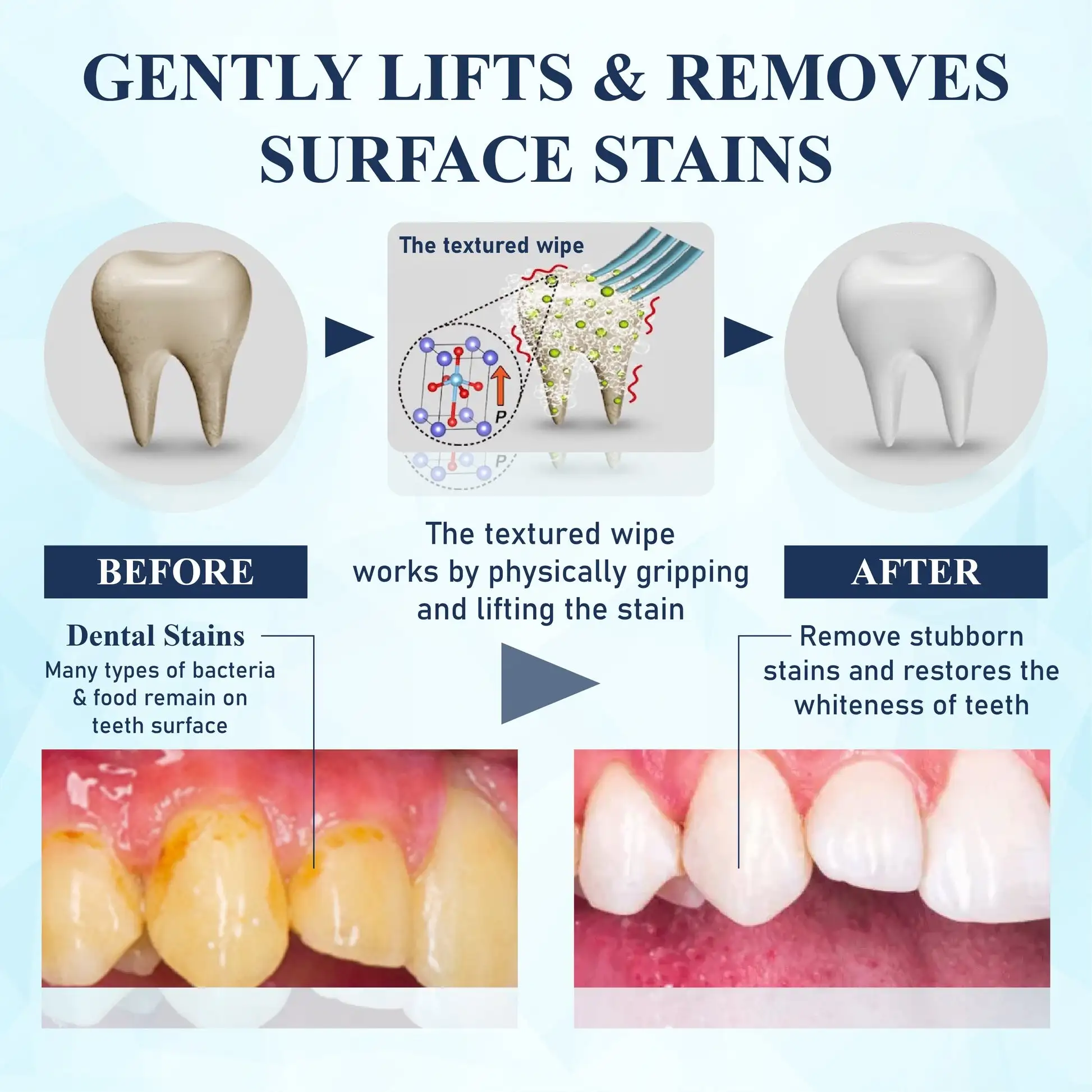 BrighteWipe Teeth Cleaning Finger Wipes - Image 2