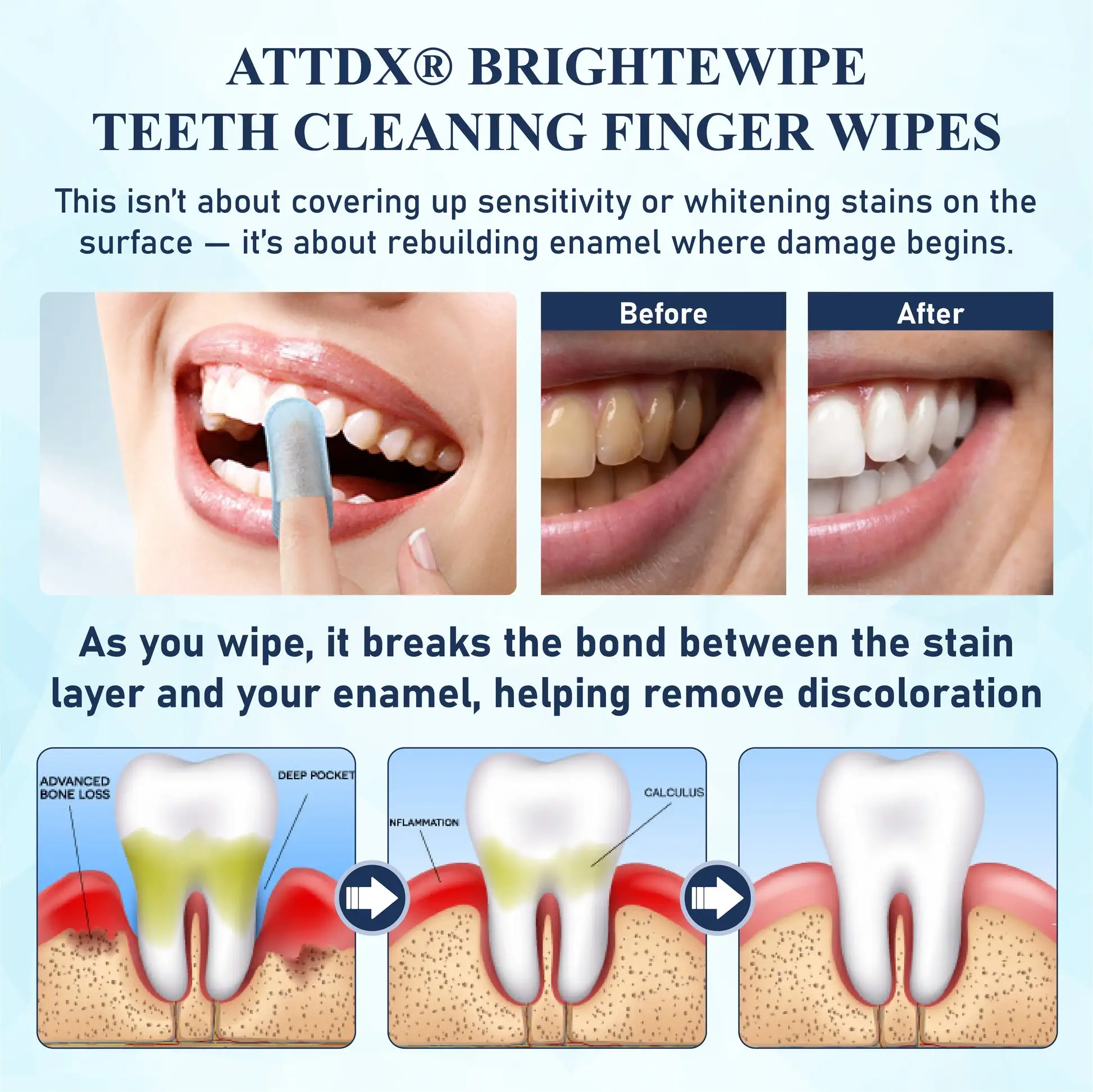 BrighteWipe Teeth Cleaning Finger Wipes - Image 3