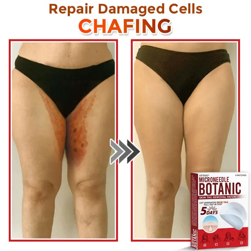 MicroNeedle Botanic Skin Tag Removal Patch - Image 3