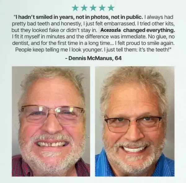 Custom-Fit Fully Functional Dentures - Image 11