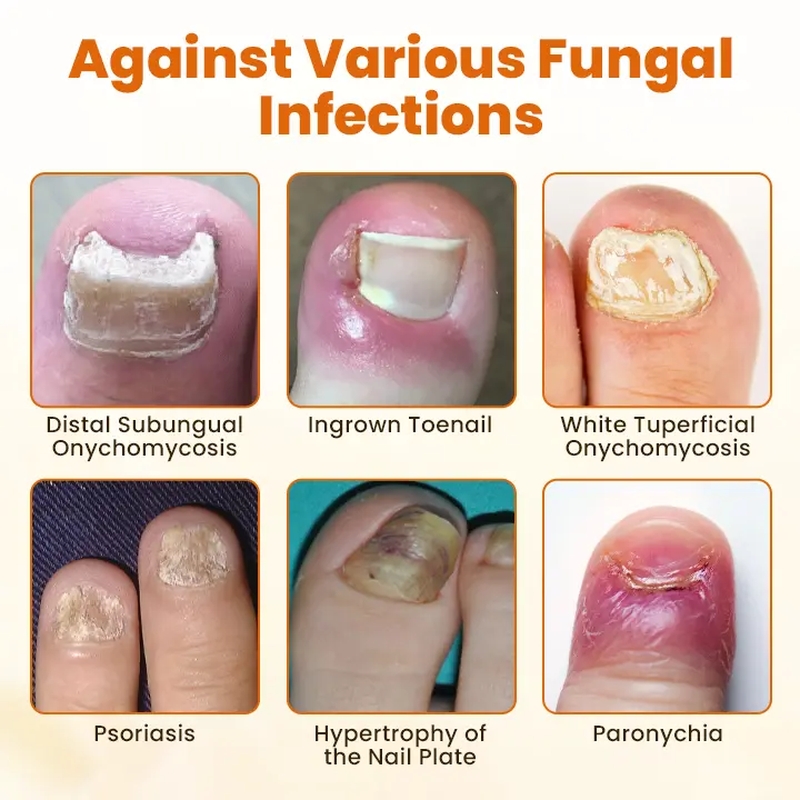 FungiBee Advanced Nail Repair Spray - Image 4