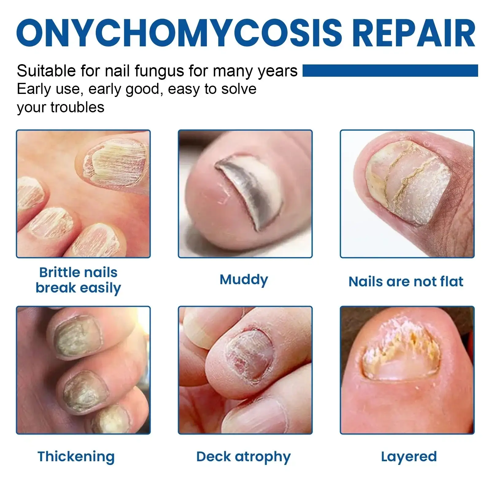 Fungus Nail Repair Patches - Image 3