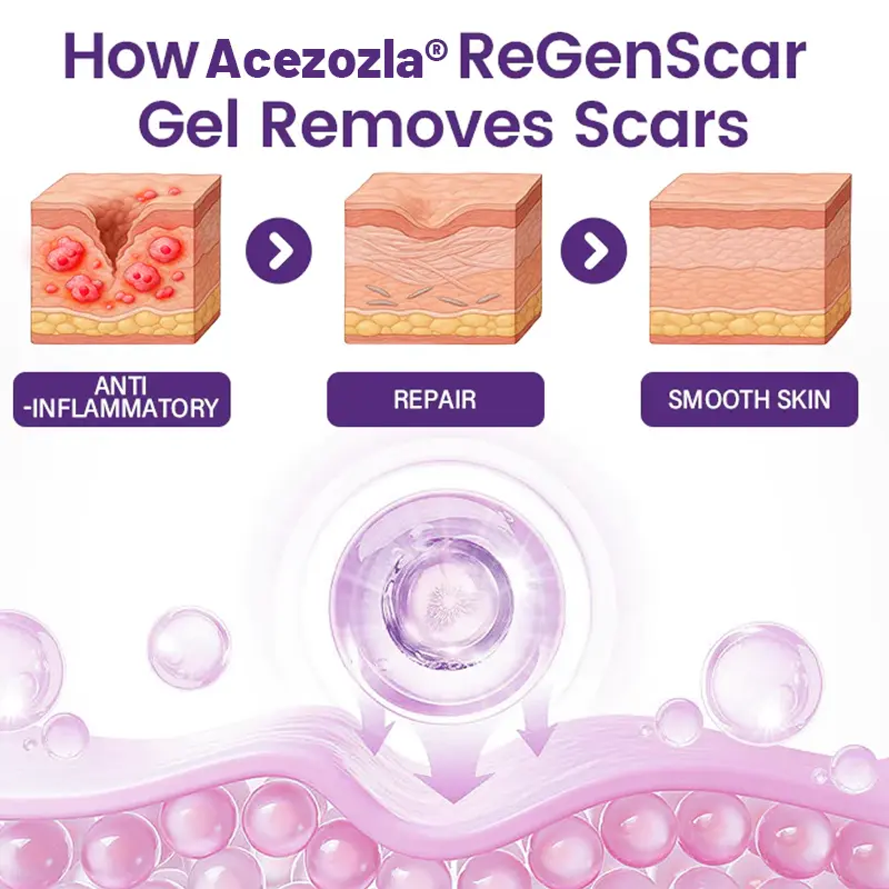 ReGenScar Stem Cell Scar Gel - Image 7