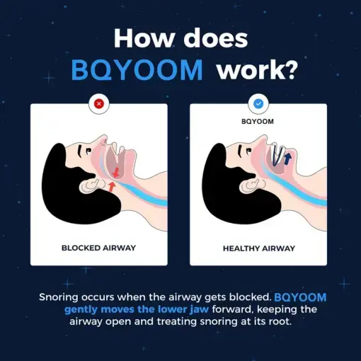 BQYOOM Adjustable Anti-Snoring Mouthpiece - Image 3