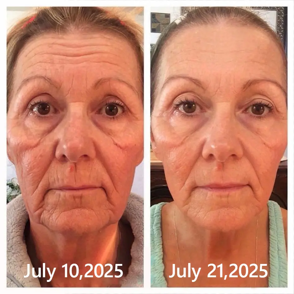 BOTOX & VITA A RETINOL SHOT Wrinkle Lift Tightening Cream - Image 52