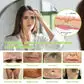 BOTOX & VITA A RETINOL SHOT Wrinkle Lift Tightening Cream - Image 38