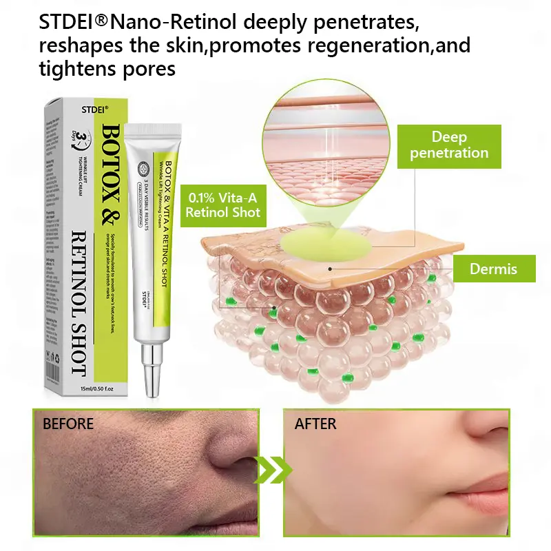 BOTOX & VITA A RETINOL SHOT Wrinkle Lift Tightening Cream - Image 61