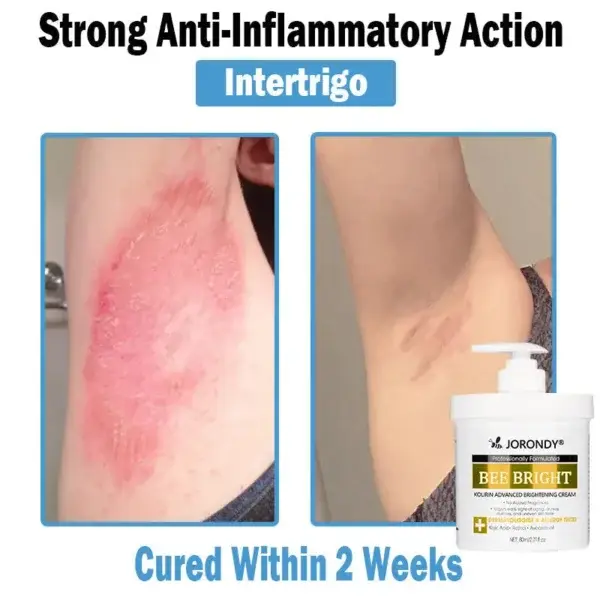 Bee Bright Multi-Symptom Skin Treatment Cream - Image 7