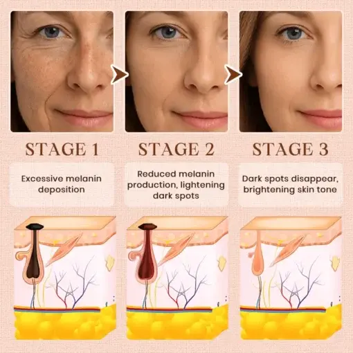 Purifying Exfoliating Gel for Acanthosis Nigricans, Exfoliation, Dark Spots, Skin Tags, and Eczema - Image 13