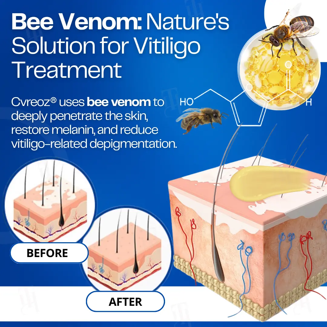 VitiClear Bee Venom Cream - Image 4
