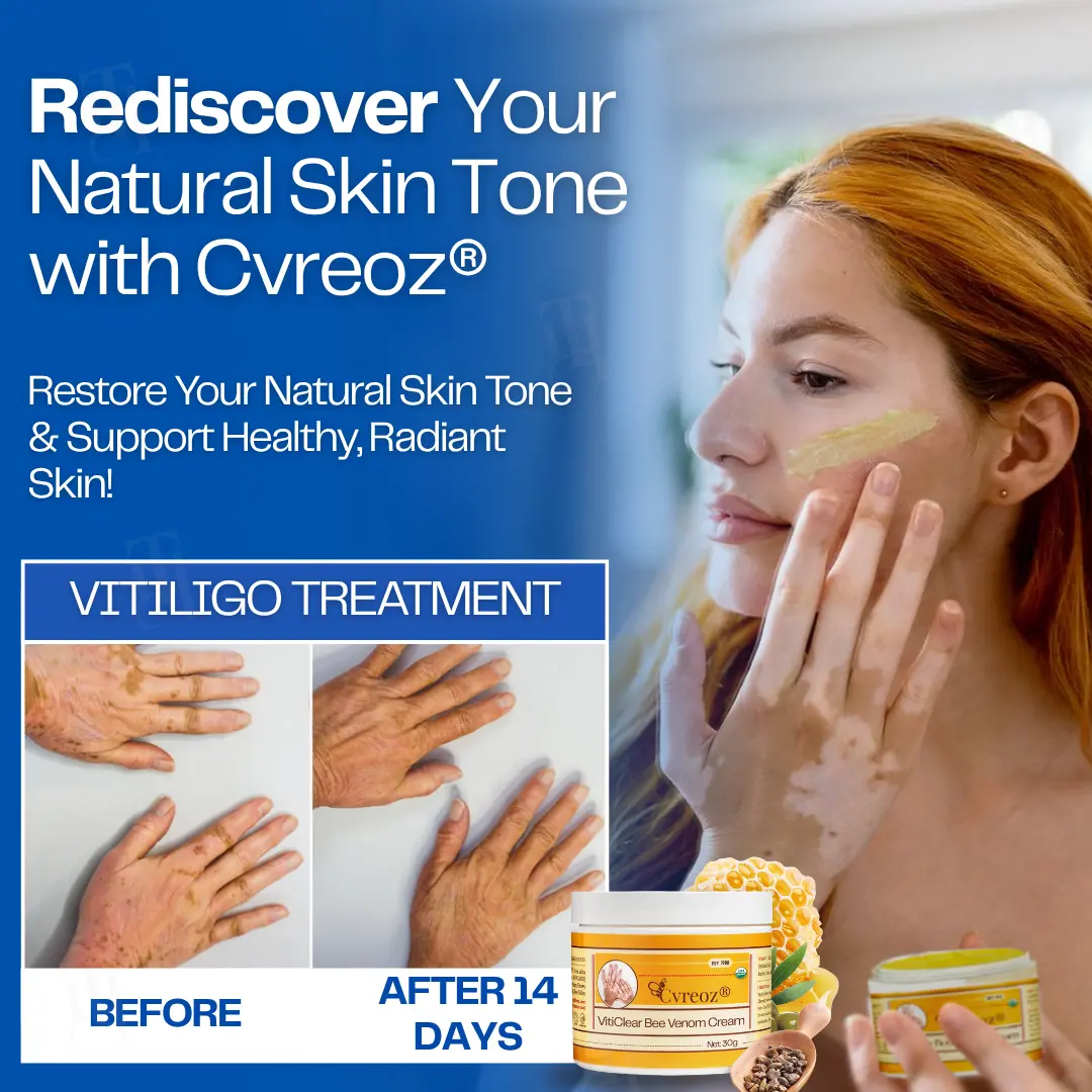 VitiClear Bee Venom Cream - Image 6
