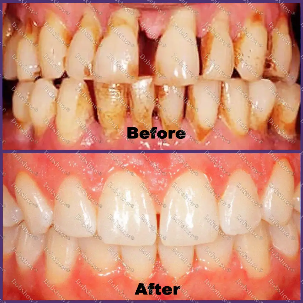 🐝 ApiCore BeeVenom Vital Repair Toothpaste - Image 2