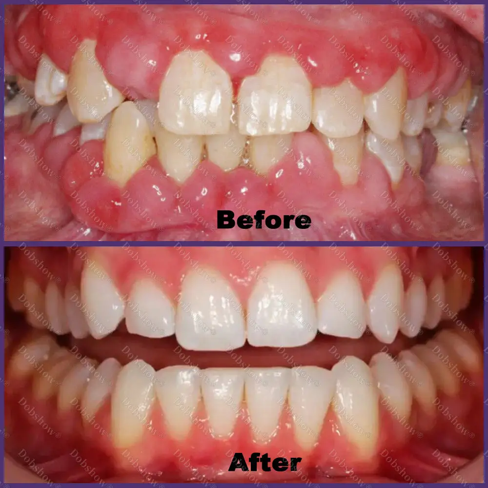 🐝 ApiCore BeeVenom Vital Repair Toothpaste - Image 3