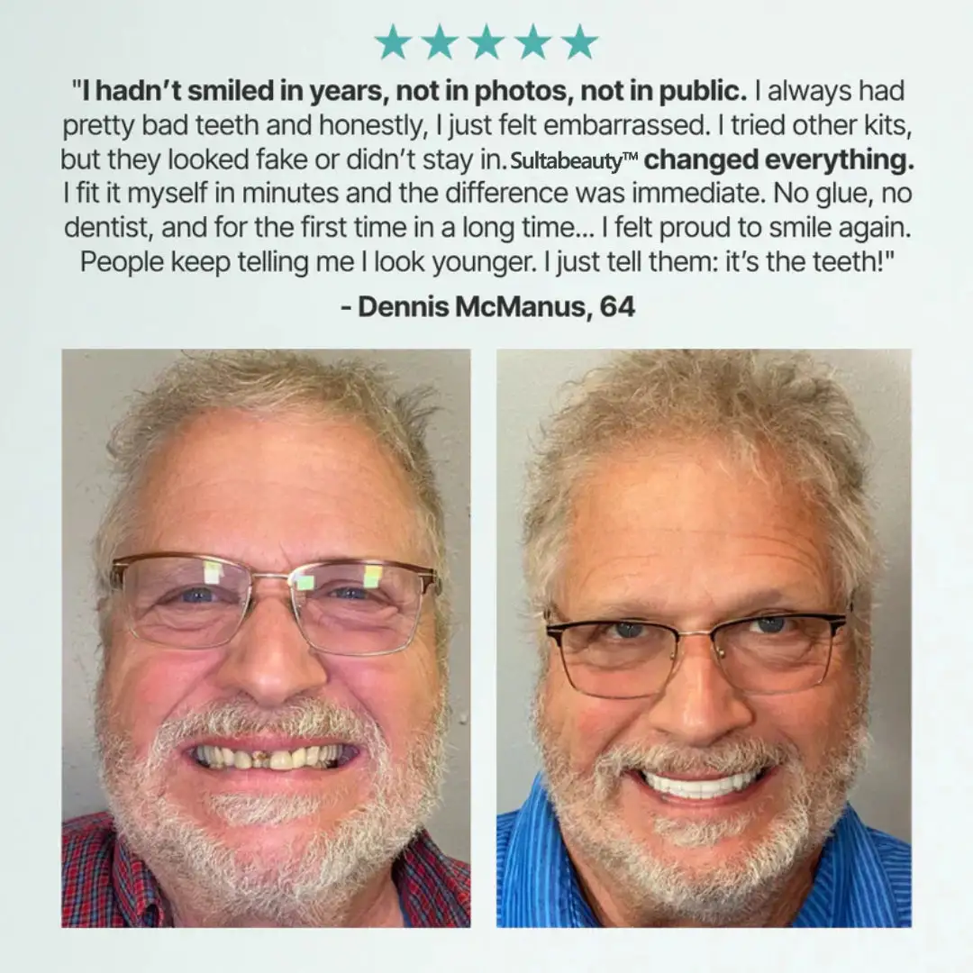 Custom-Fit Full Functional Dentures Make you more confident - Image 10