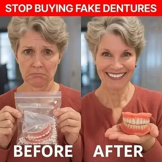 🌎Ends Today: 70% OFF! Medical Full Denture with Strong Suction - Image 3