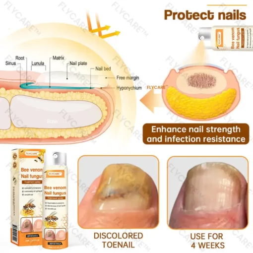Bee Venom Nail Fungus Spray - Image 5