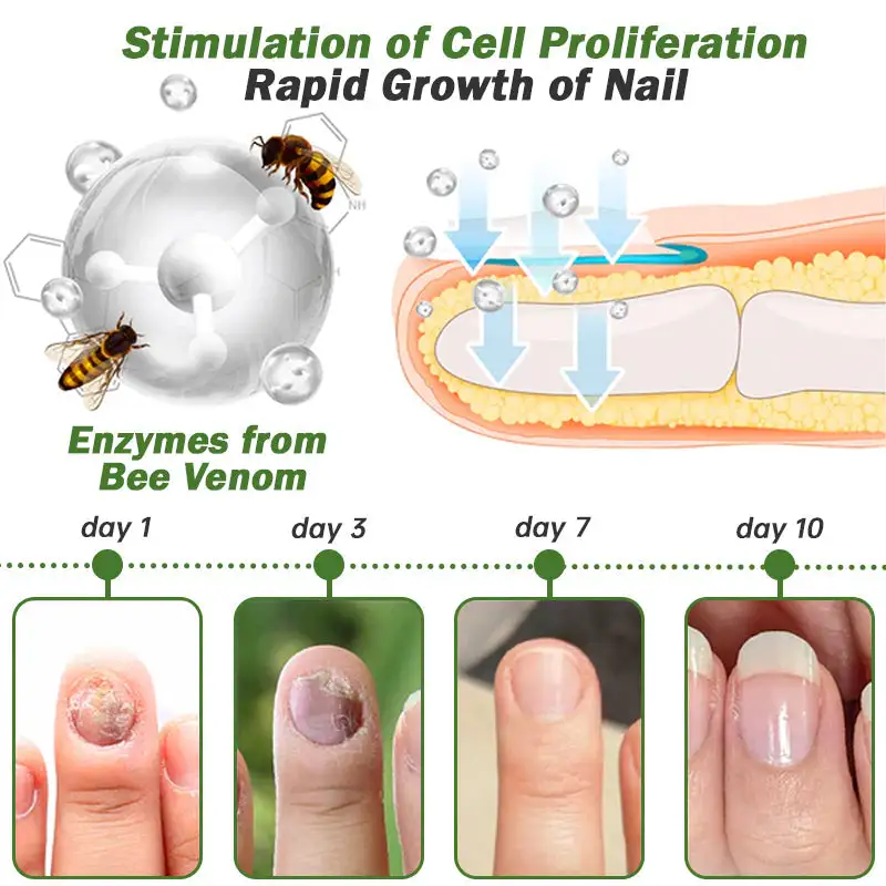 Nail Fungus Treatment Serum - Image 11