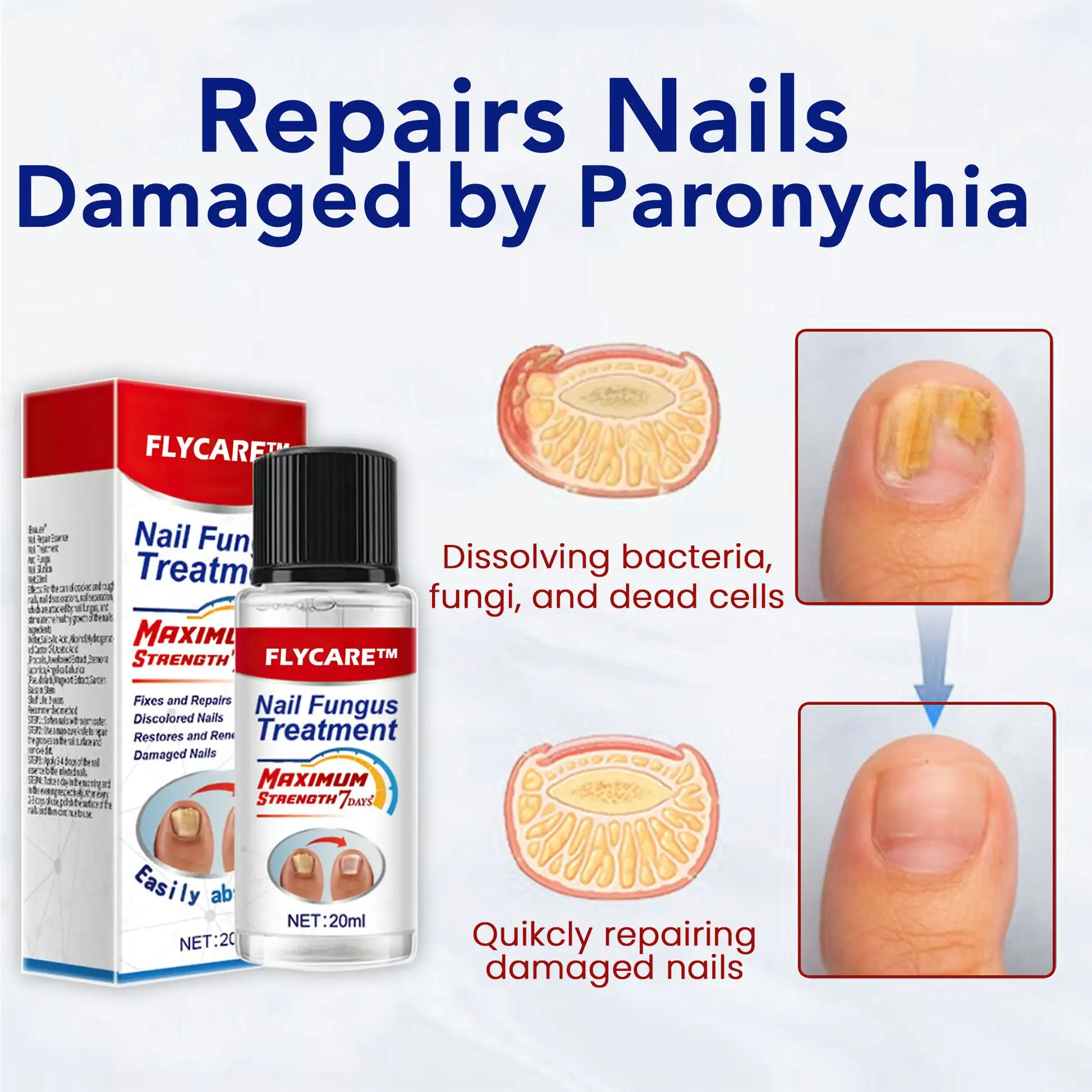 Nail Fungus Treatment Serum - Image 3