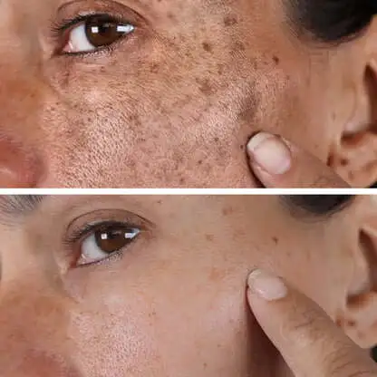 Melanin Correcting Facial Serum - Image 5