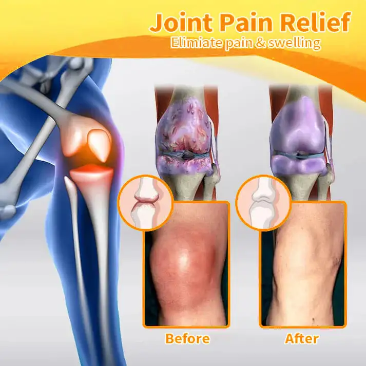Bee Venom & Turmeric Joint and Bone Pain Relief Cream - Image 11