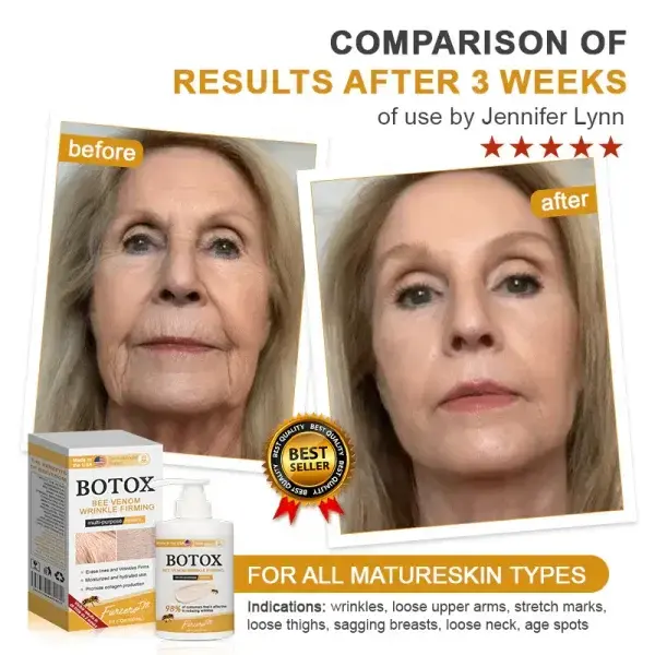 Botox Bee Venom Wrinkle - Image 12