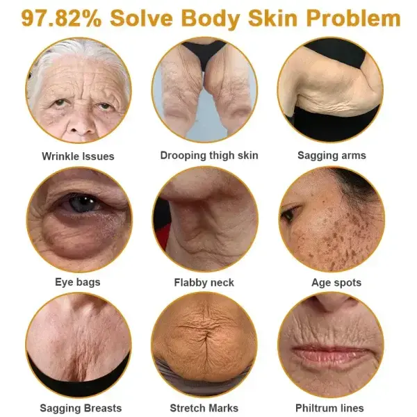 Botox Bee Venom Wrinkle - Image 4
