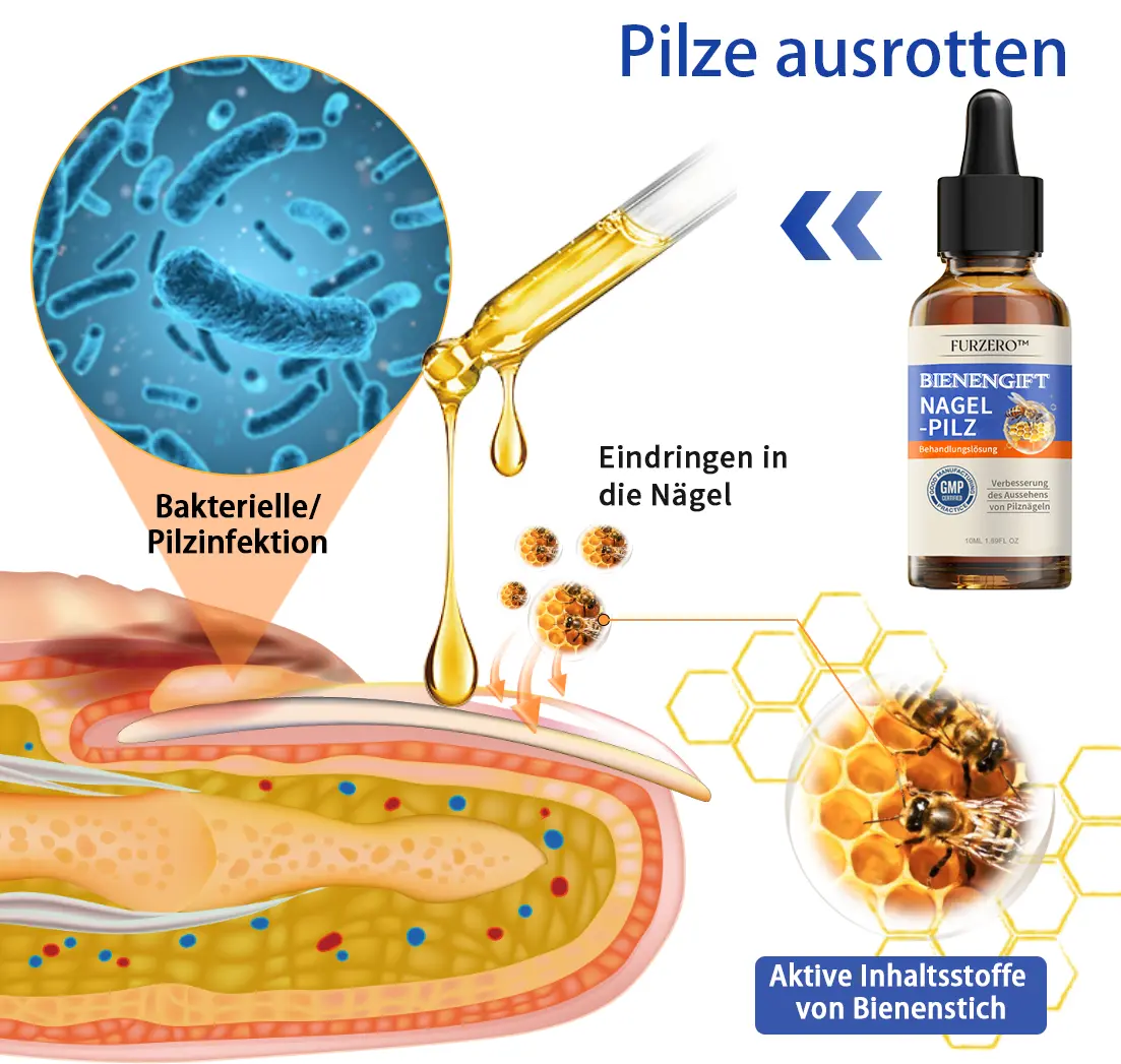 Bee Venom Nail Fungus Treatment Solution - Image 3