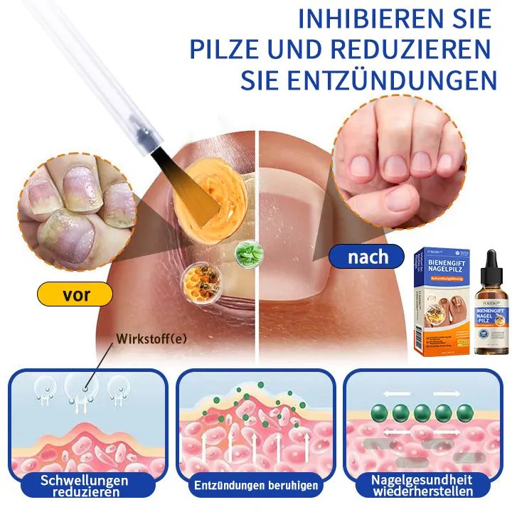 Bee Venom Nail Fungus Treatment Solution - Image 5