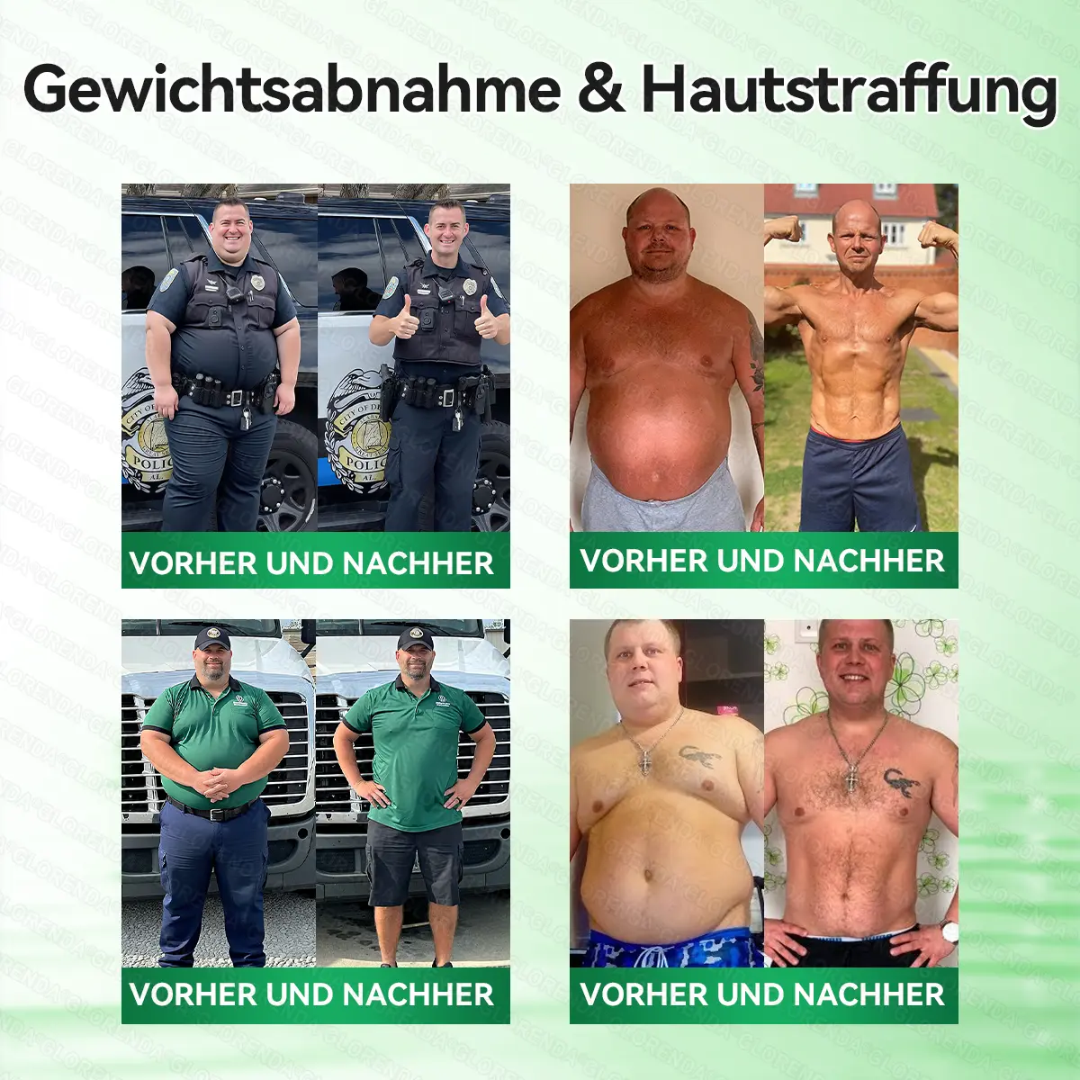 Moringa· Berberin x NAD+ FortschrittlichesNano-Mikronadel-Pflaster 10-in-1 - Image 2