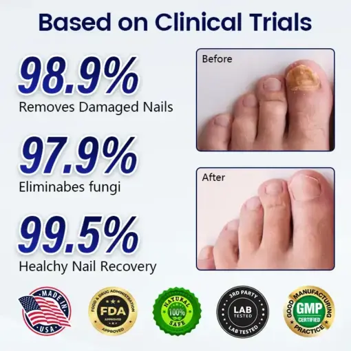 Anti-Fungal Nail Repair Patch - Image 2