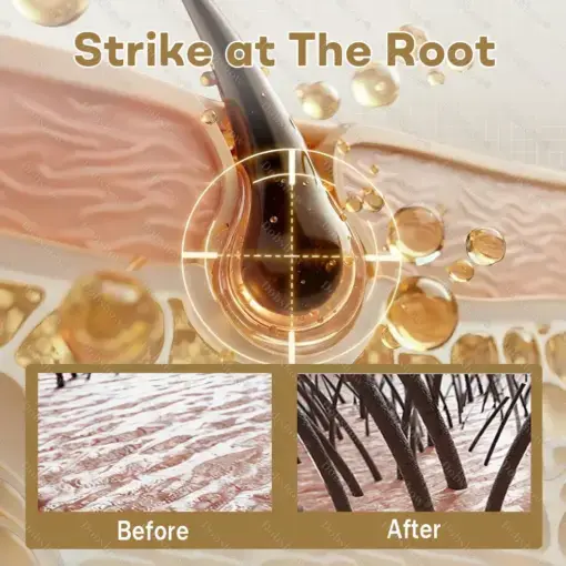 Hair Regrowth Capsules Nano Penetration, Deep into Hair Roots - Image 6
