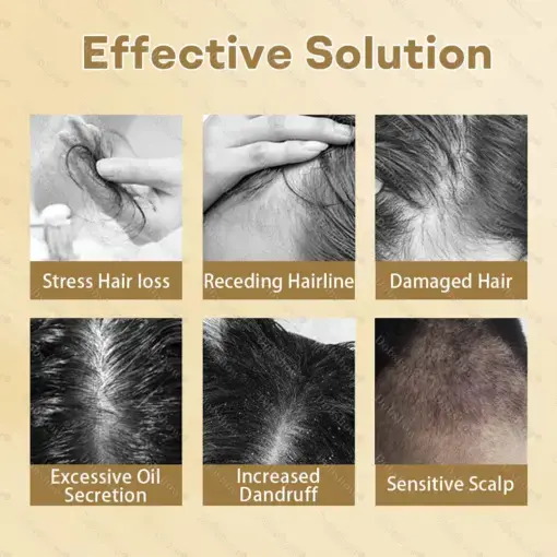 Hair Regrowth Capsules Newly Upgraded,Nano Penetration, Deep into Hair Roots - Image 3