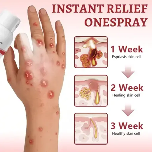Snail Mucin Healing Spray - Image 5