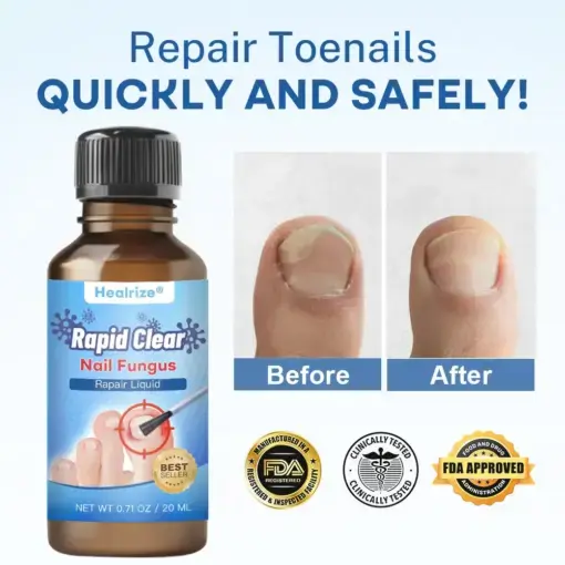 Nano Rapid Clear Nail Fungus Rapair Liquid Effective in 7 Days, Permanently Eliminates the Root - Image 2