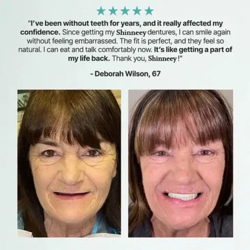 Custom Fit for a Fresh Smile, Say Goodbye to Wearing Discomfort! - Image 12