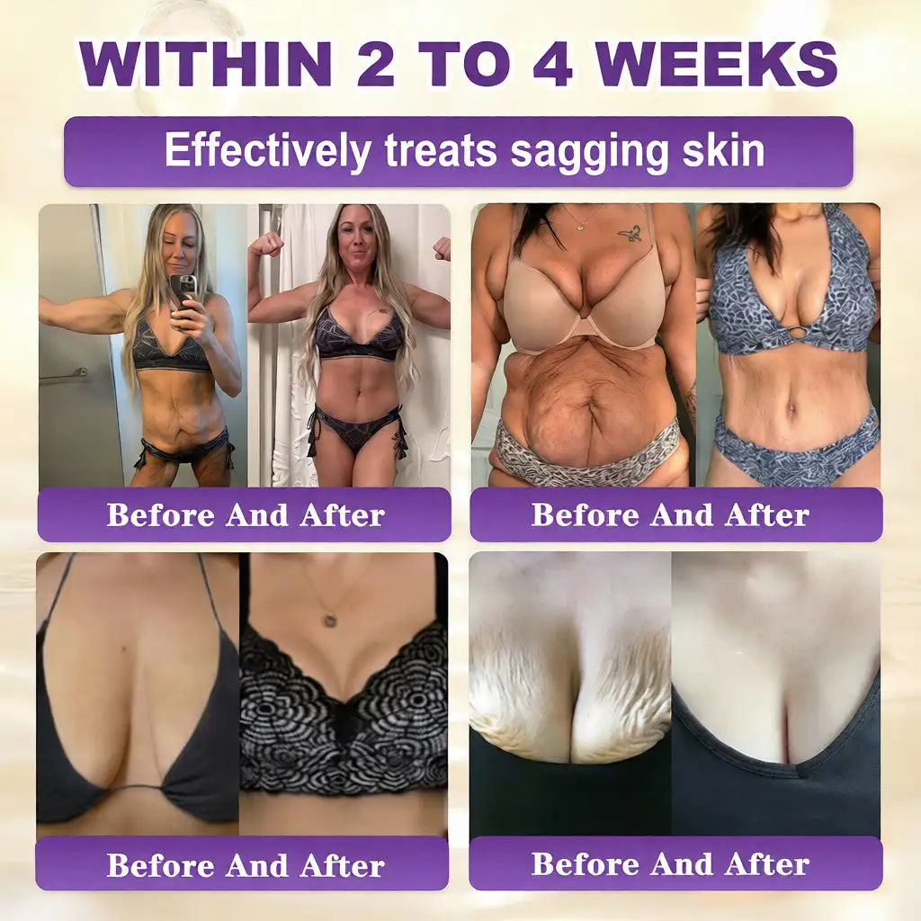 🔥LAST DAY 50% OFF Biotin 10-in-1 Skin Restoration Cream - Image 3