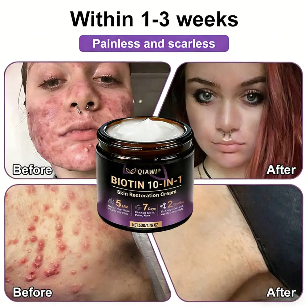 🔥LAST DAY 50% OFF Biotin 10-in-1 Skin Restoration Cream - Image 6