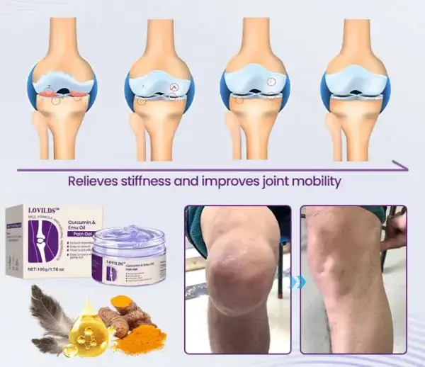LAST DAY SALE – 80% OFF Curcumin & Emu Oil Pain Gel – Backed by US Osteopathic Experts - Image 10