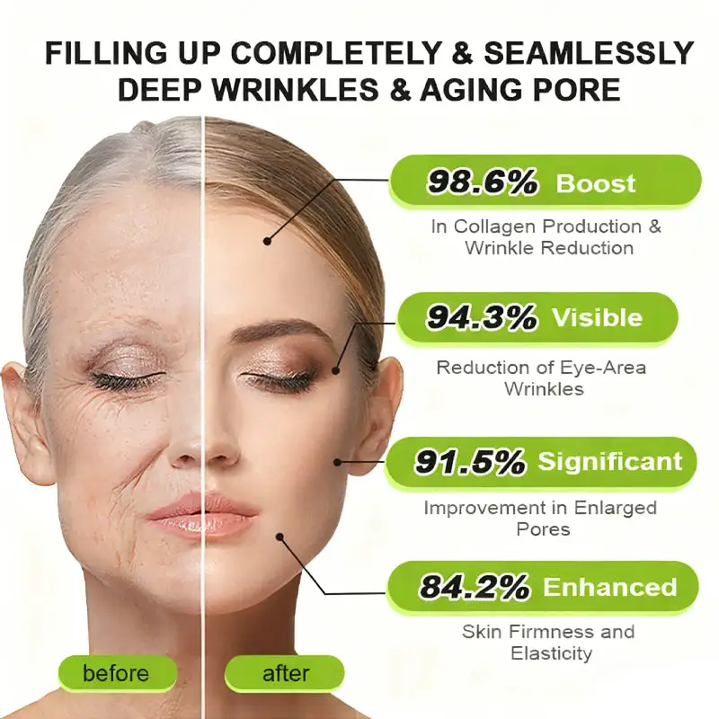 Botox & Vita-A Retinol Shot Wrinkle-Lift Tightening Cream - Image 3