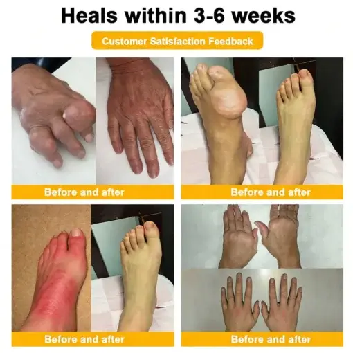 Bee Poison Pain-Relief Bone Healing Cream (Specially for older adults) - Image 4
