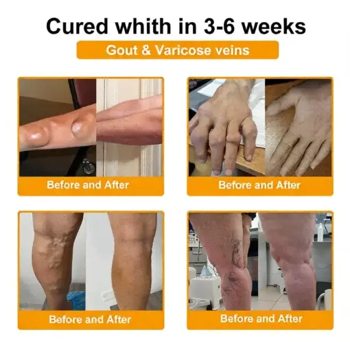 Bee Poison Pain-Relief Bone Healing Cream (Specially for older adults) - Image 5