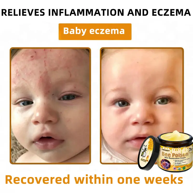 🐝Bee Poison Skin Restoration Cream 🐝 - Image 8