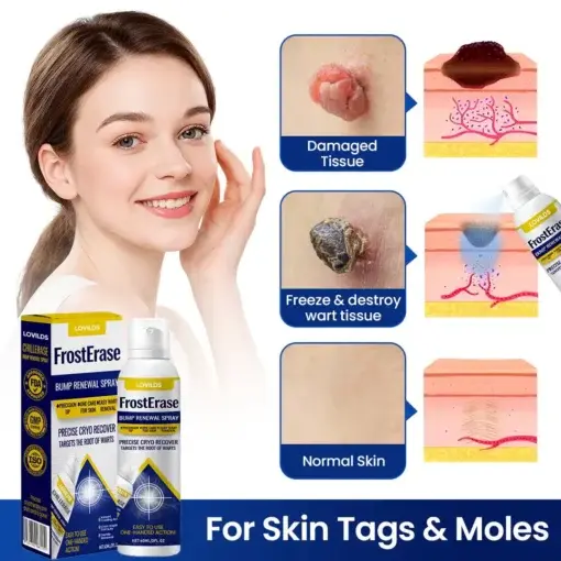 FrostErase Bump Renewal Spray - Image 6