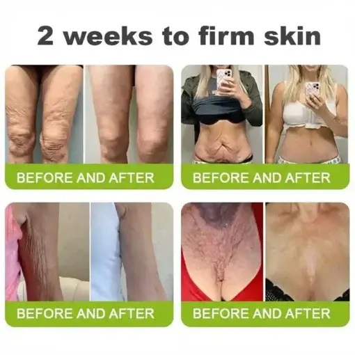 moringa Vita-A Retinol Shot Wrinkle-Lift Tightening cream – Last Day Promotion 50 OFF - Image 8