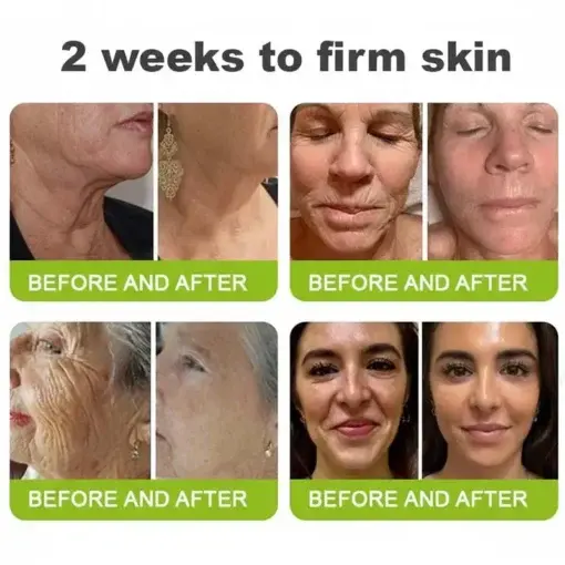 moringa Vita-A Retinol Shot Wrinkle-Lift Tightening cream – Last Day Promotion 50 OFF - Image 7