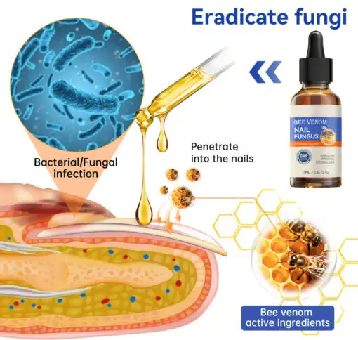 Bee Venom Nail Fungus Treatment Solution - Image 5