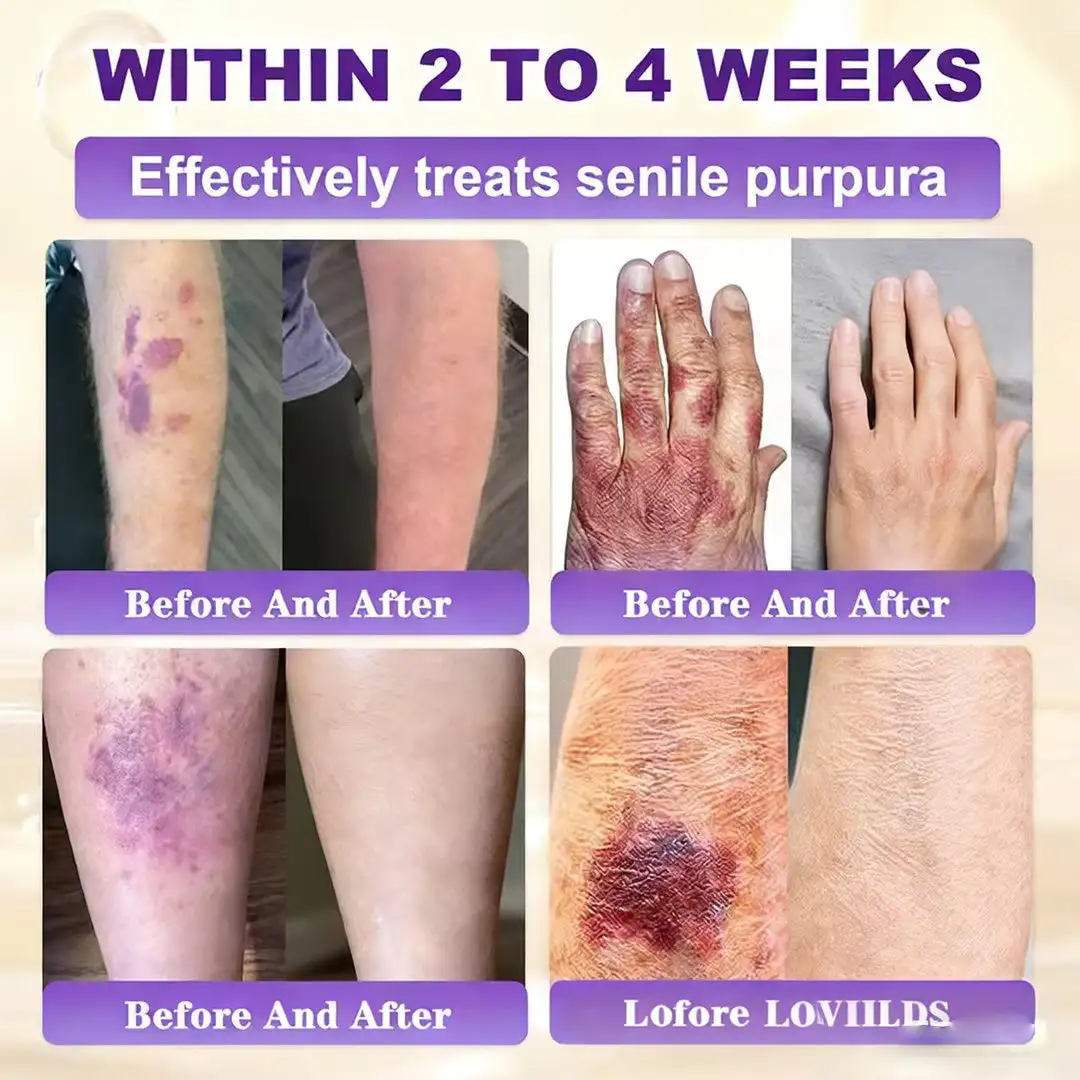 Made and Shipped from UK Biotin 10-in-1 Skin Restoration Cream - Image 6