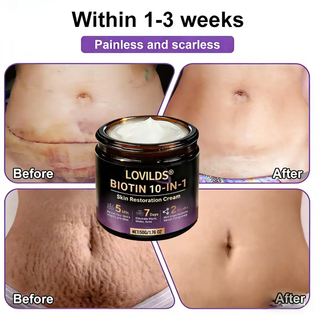 Biotin 10-in-1 Skin Restoration Cream - Image 5