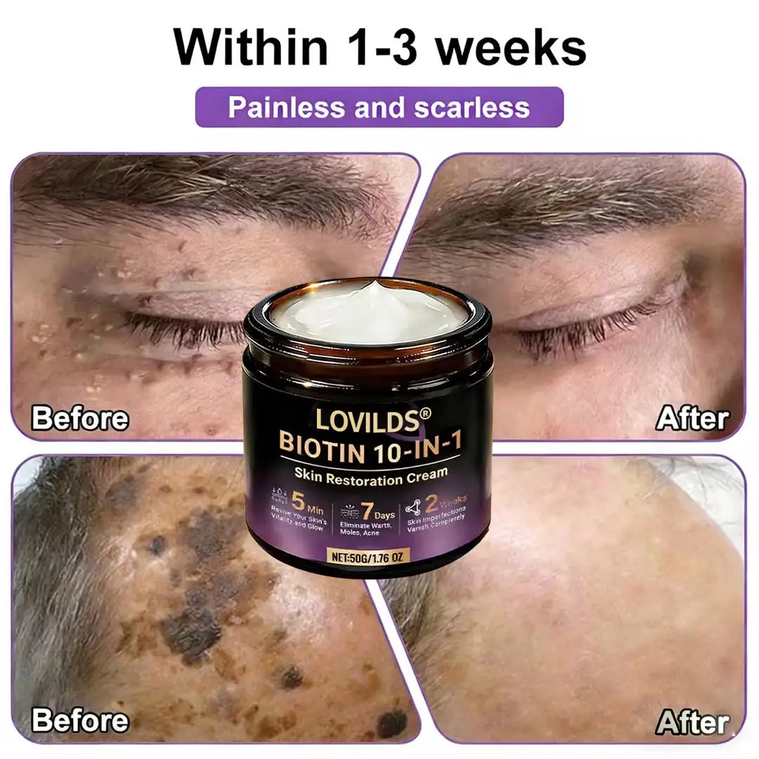 Made and Shipped from UK Biotin 10-in-1 Skin Restoration Cream🌻🌻 - Image 7