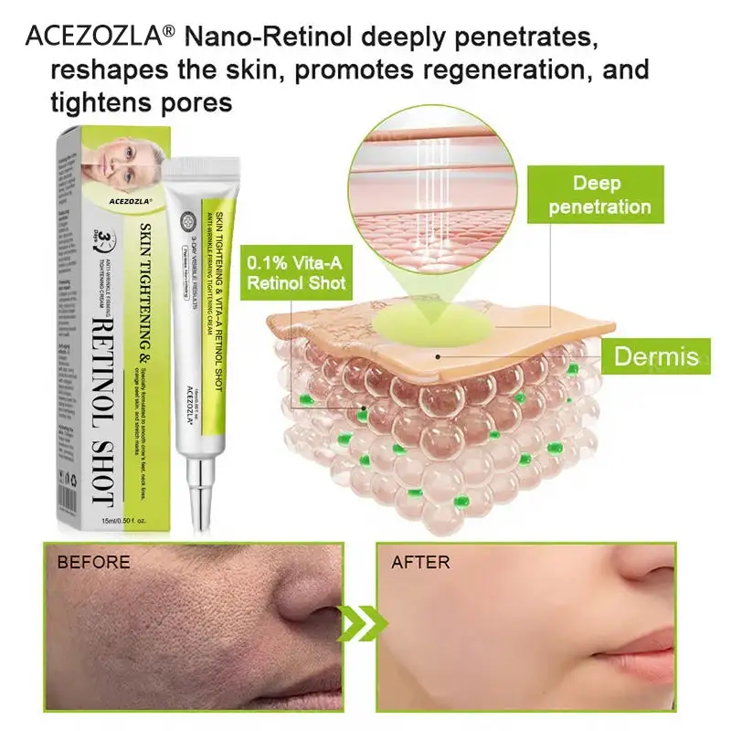 Skin Tightening & Vita-A Retinol Retinol shot Anti-Wrinkle Firming Tightening cream - Image 12